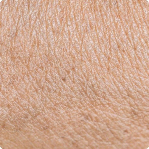 Aging Skin