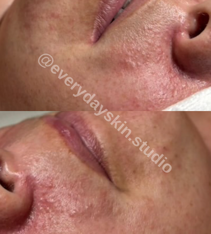Before treatment